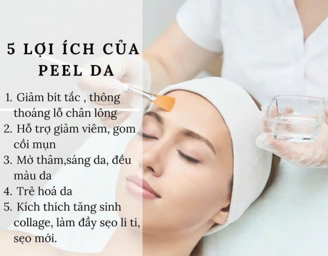 Lợi Ích Của Peel Da Tại Dung Nguyễn Spa