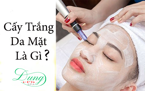 Cấy trắng da mặt là gì