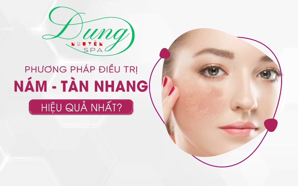 Phương Pháp Trị Nám, Tàn Nhang Tại Dung Nguyễn Spa