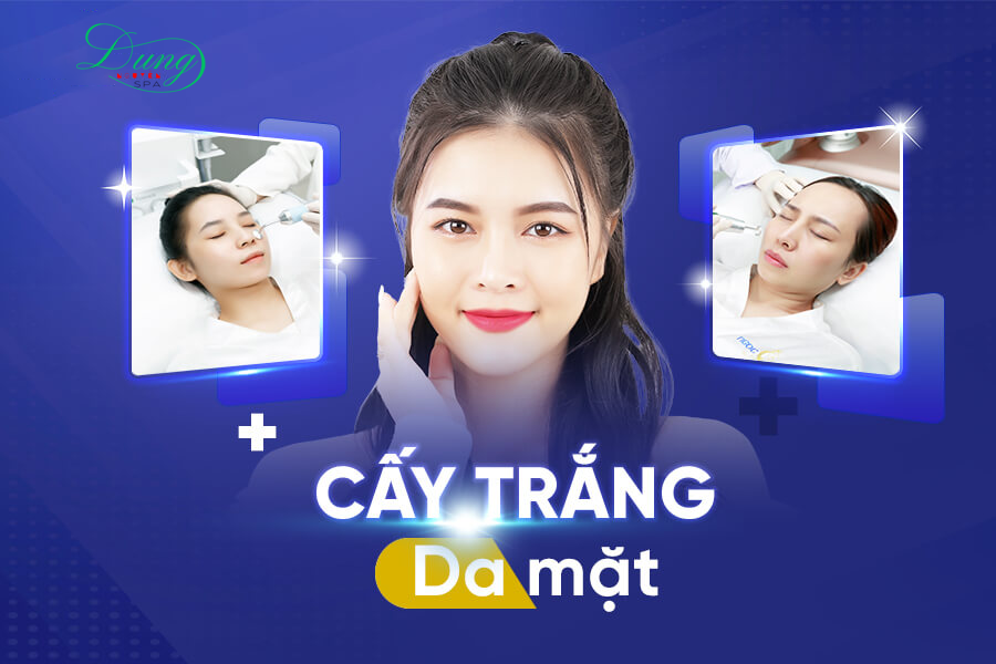 Cấy trắng da mặt