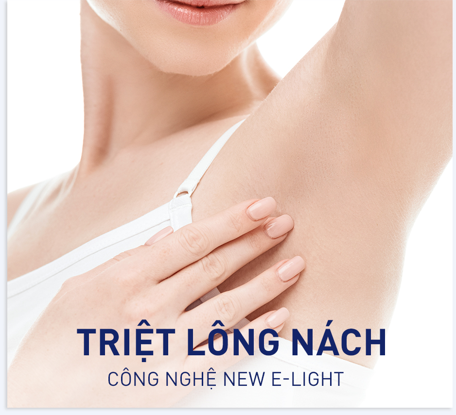 Triệt Lông Nách Vĩnh Viễn