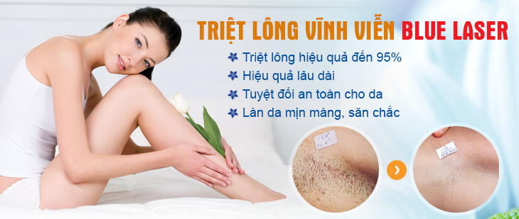 ​​​​Triệt Lông Tay Chân Dĩ An Bình Dương